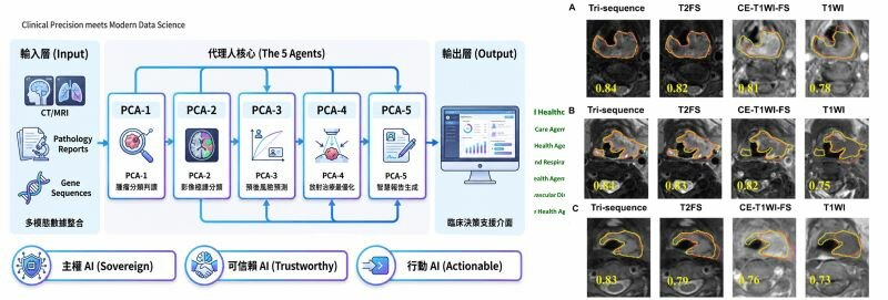 團隊建構Proactive Cancer Agents多代理人系統，朝「AI先分析、醫師審閱」的人機協作模式推進。(圖片來源/臺大AI中心)